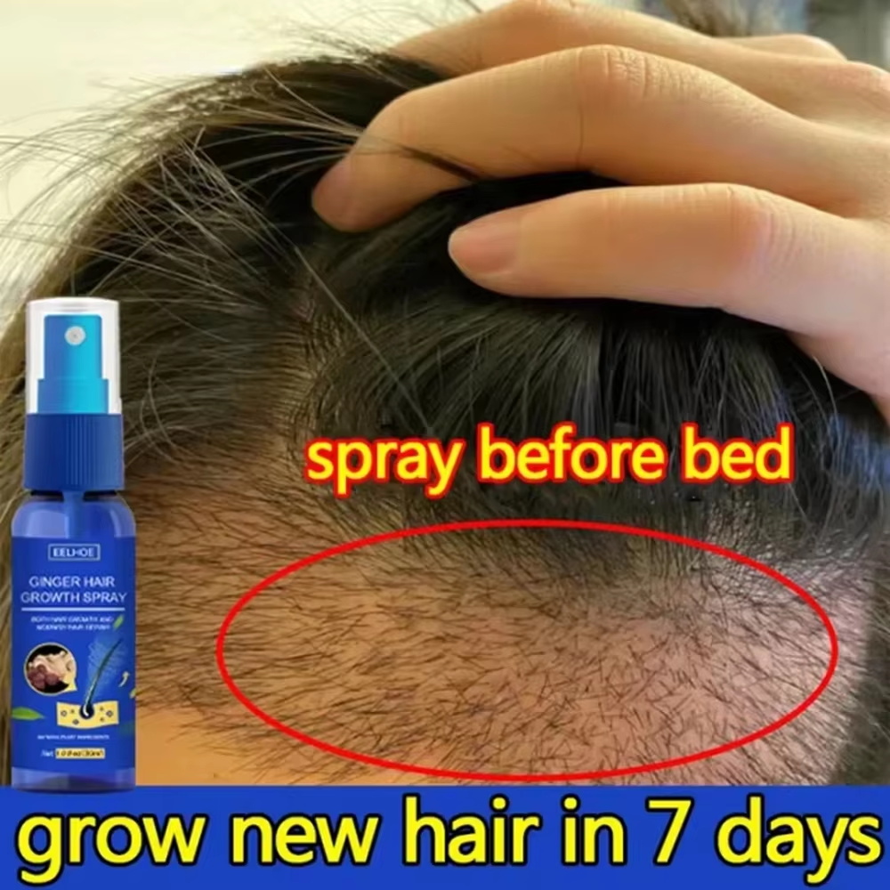 Hair Care Lotion - Hızlı Zencefilli Saç Uzatma Spreyi, Saç