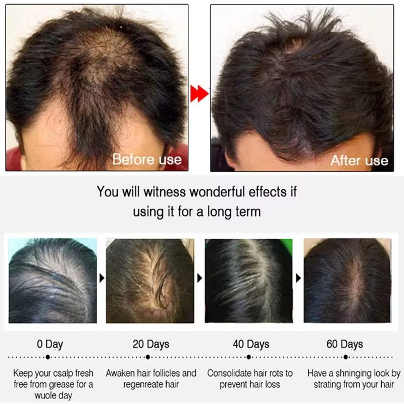 Hızlı Zencefilli Saç Uzatma Sp - Hair Care Lotion incelemesi ve fiyatı