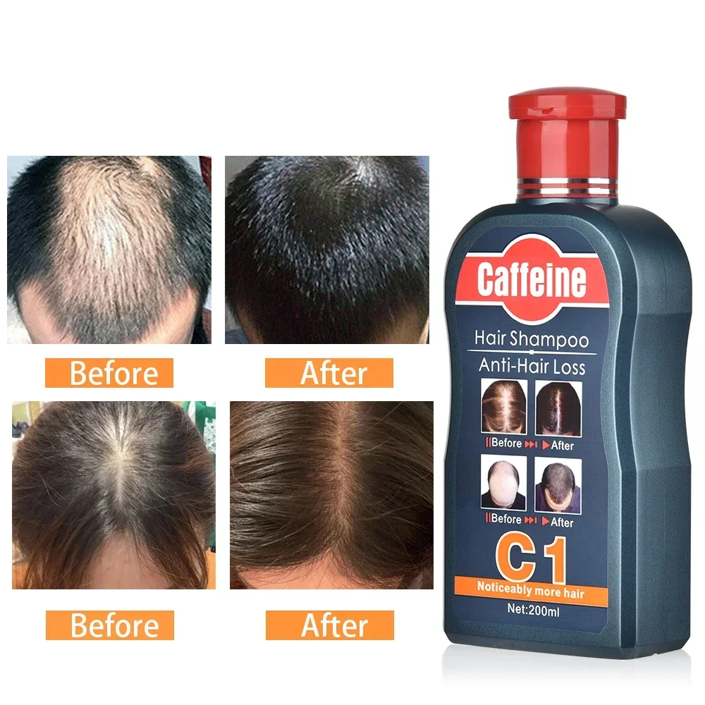 Erkekler Şampuanı Saç Büyüme D - Hair Care Korean Products incelemesi ve fiyatı